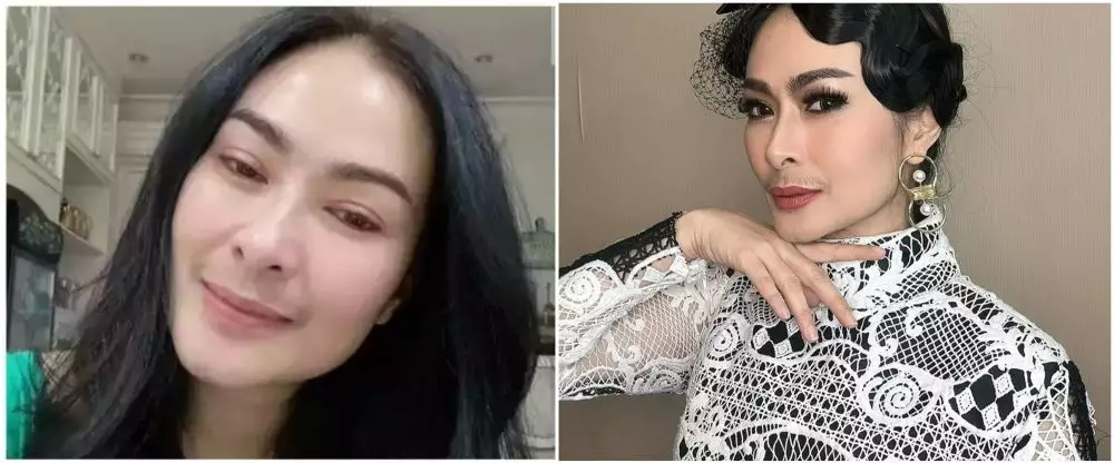 penyanyi suntik botoks. berbagai sumber