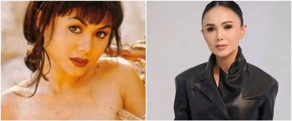 penyanyi suntik botoks. berbagai sumber