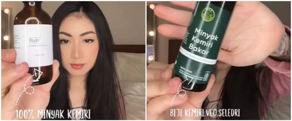 Battle review 2 minyak kemiri bisa suburkan rambut TikTok