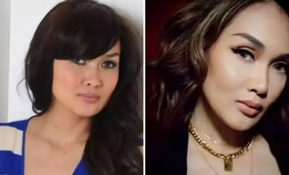 Potret seleb cewek sebelum dan sesudah lakukan filler dagu Berbagai sumber