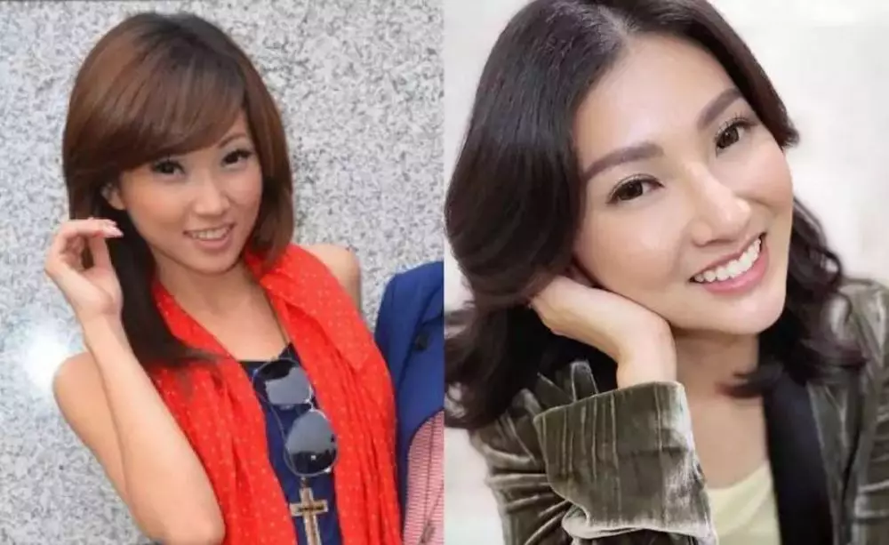 Potret seleb cewek sebelum dan sesudah lakukan filler dagu Berbagai sumber