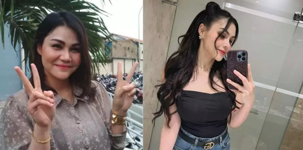 Potret seleb cewek sebelum dan sesudah lakukan filler dagu Berbagai sumber