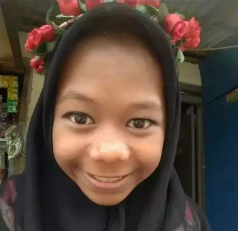 perubahan wajah cimoy  berbagai sumber