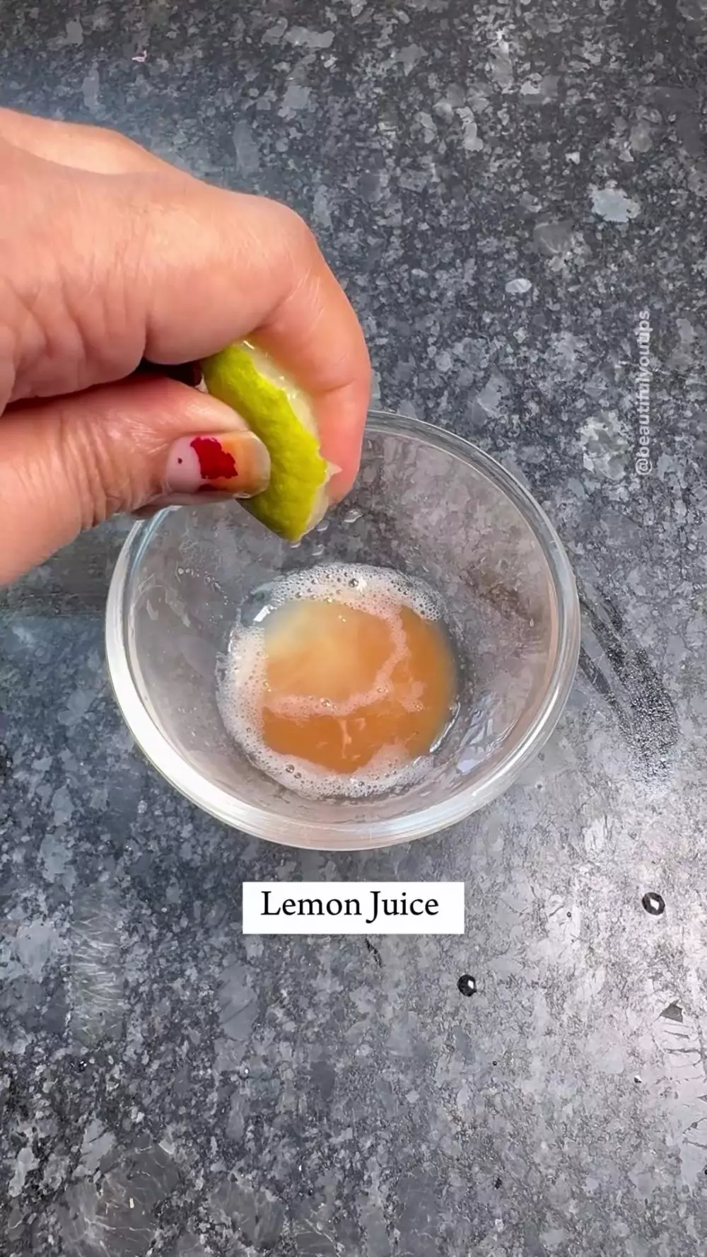 hilangkan komedo berbagai sumber