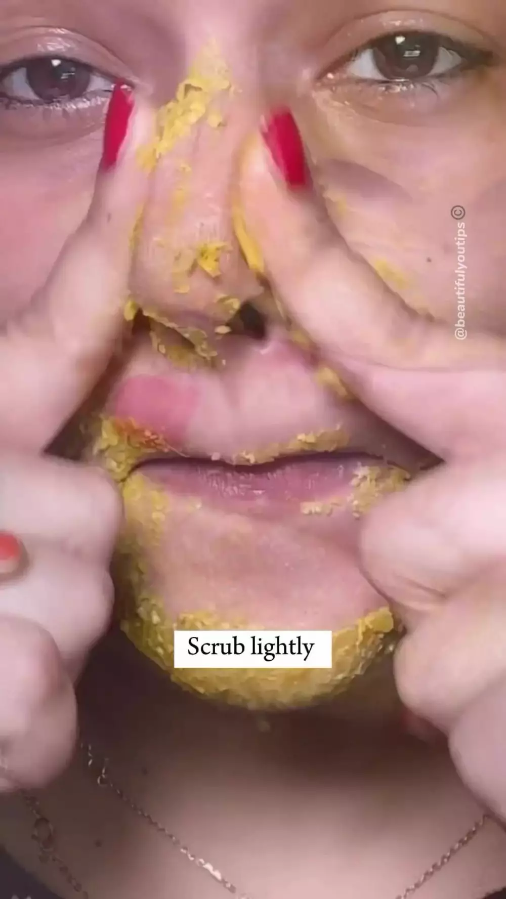 hilangkan komedo berbagai sumber