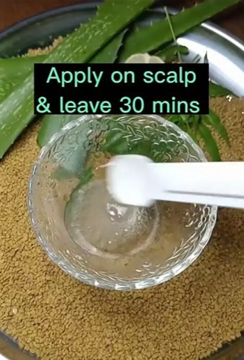 Atasi ketombe membandel TikToker Berbagai sumber Atasi ketombe membandel TikToker Berbagai sumber