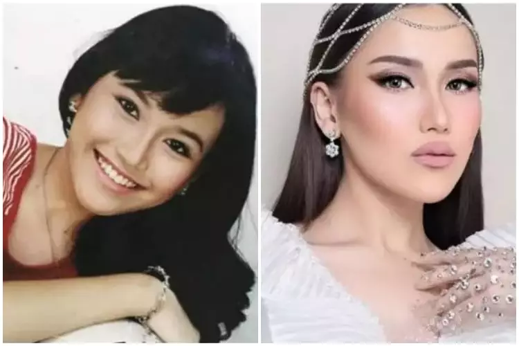 Potret Ayu Ting Ting sebelum & sesudah kenal treatment klinik kecantikan Berbagai sumber