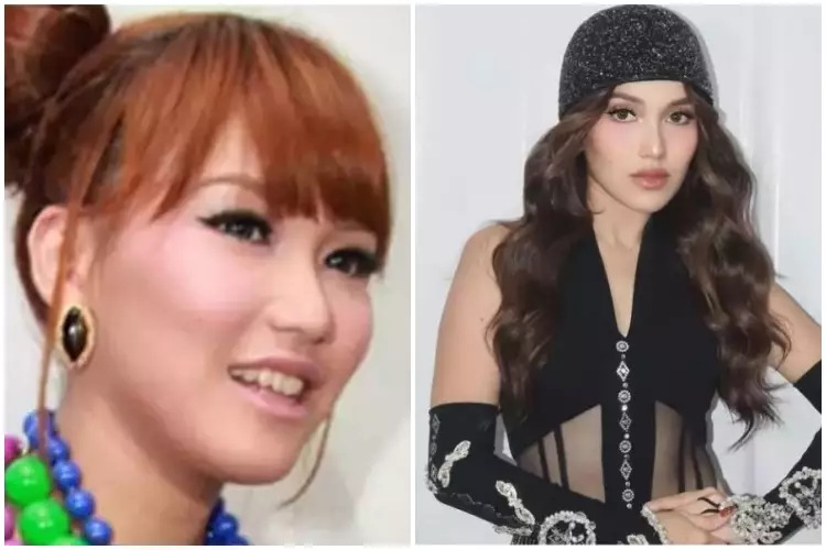 Potret Ayu Ting Ting sebelum & sesudah kenal treatment klinik kecantikan Berbagai sumber