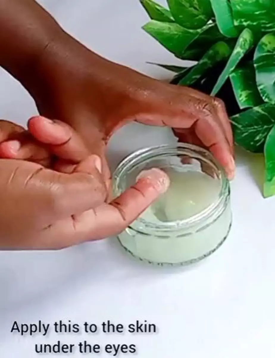 Atasi mata panda pakai petroleum jelly dan aloe vera gel Berbagai sumber