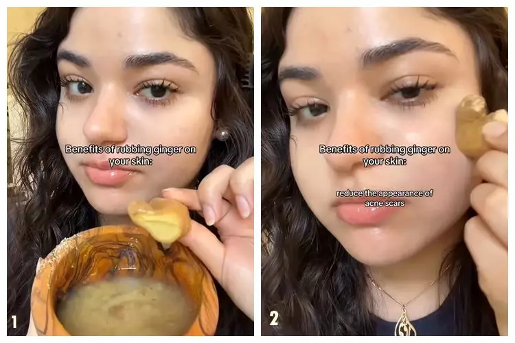 hilangkan jerawat pakai jahe. berbagai sumber