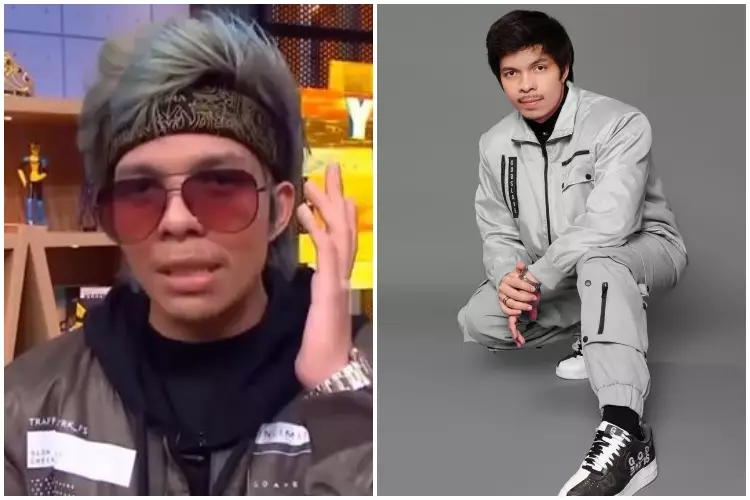 Potret Atta Halilintar sebelum & sesudah rutin treatment Berbagai sumber