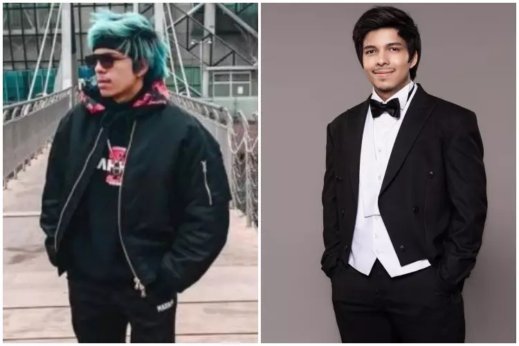 Potret Atta Halilintar sebelum & sesudah rutin treatment Berbagai sumber