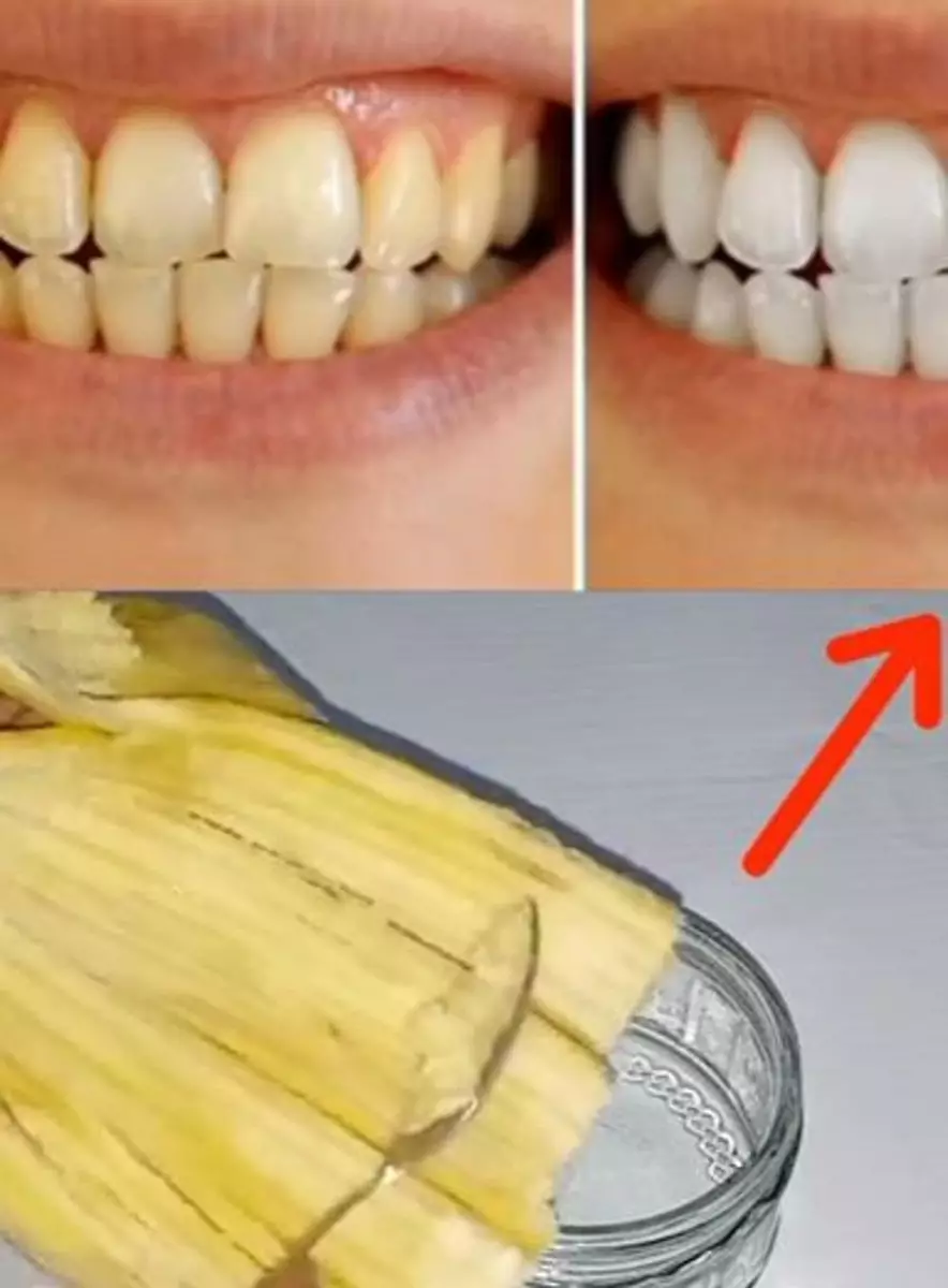 Atasi gigi berkerak kuning cuma pakai 2 jenis buah Berbagai sumber Atasi gigi berkerak kuning cuma pakai 2 jenis buah Berbagai sumber