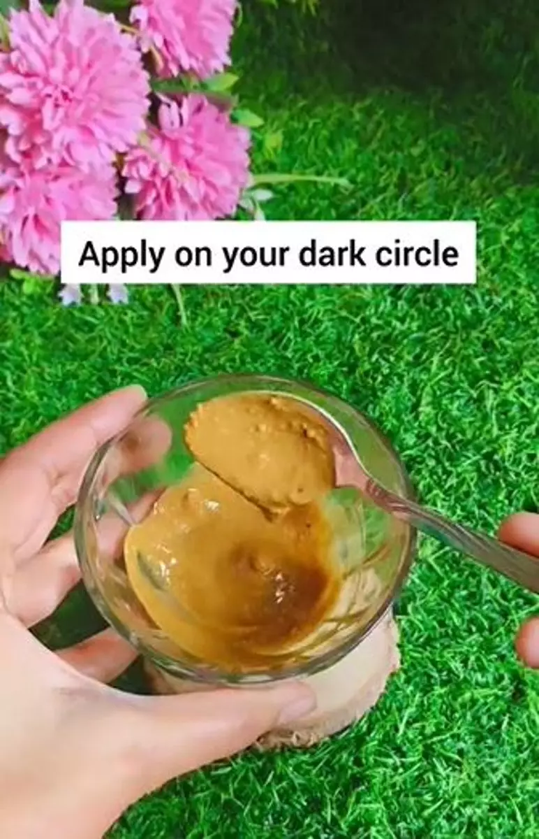 Cerahkan dark circle cewek TikTok  Berbagai sumber Cerahkan dark circle cewek TikTok  Berbagai sumber