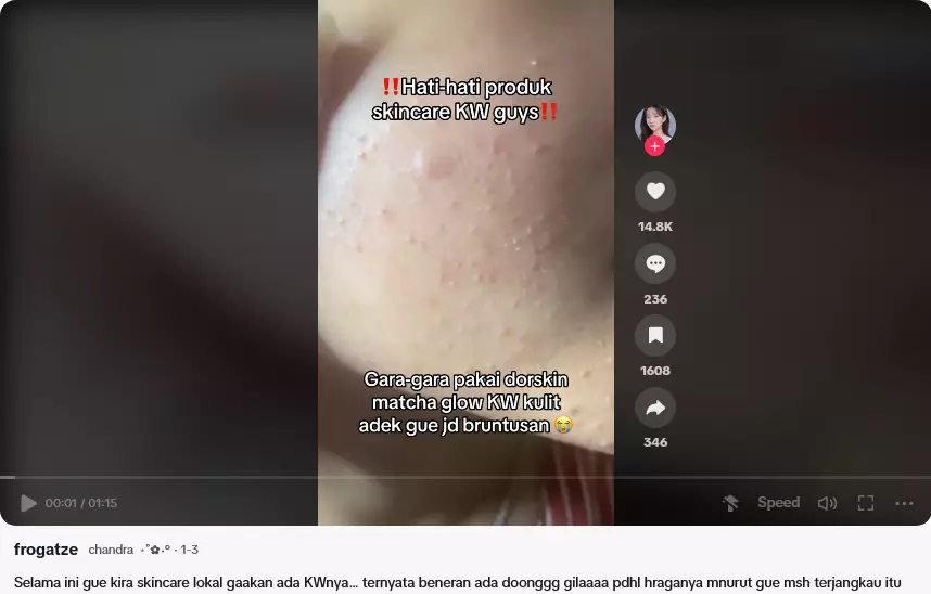 cara bedakan produk Dorskin Matcha asli dan palsu TikTok cara bedakan produk Dorskin Matcha asli dan palsu TikTok