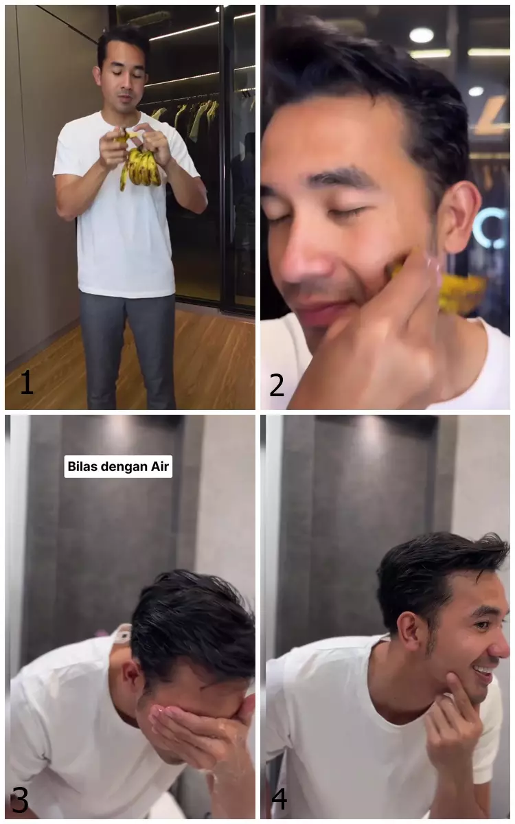 hilangkan bekas jerawat kulit pisang. berbagai sumber