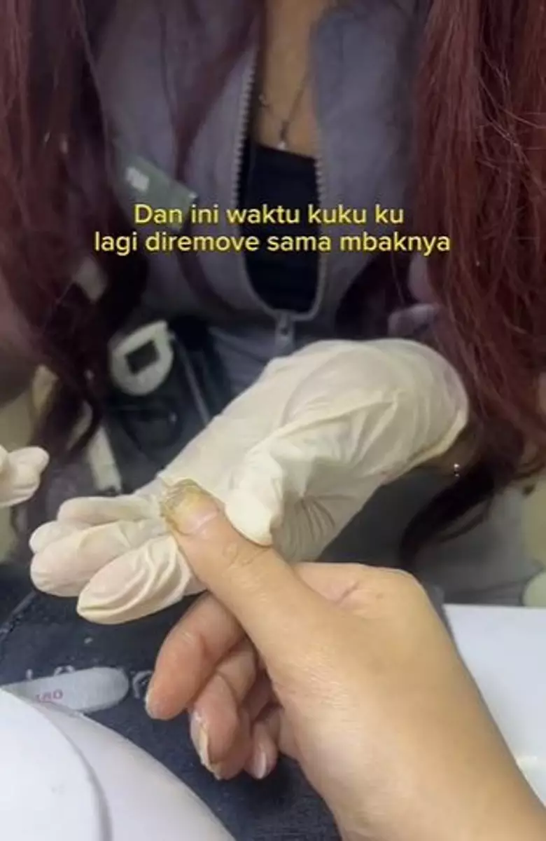 Kuku selebgram ini jadi busuk usai lakukan nail art TikTok