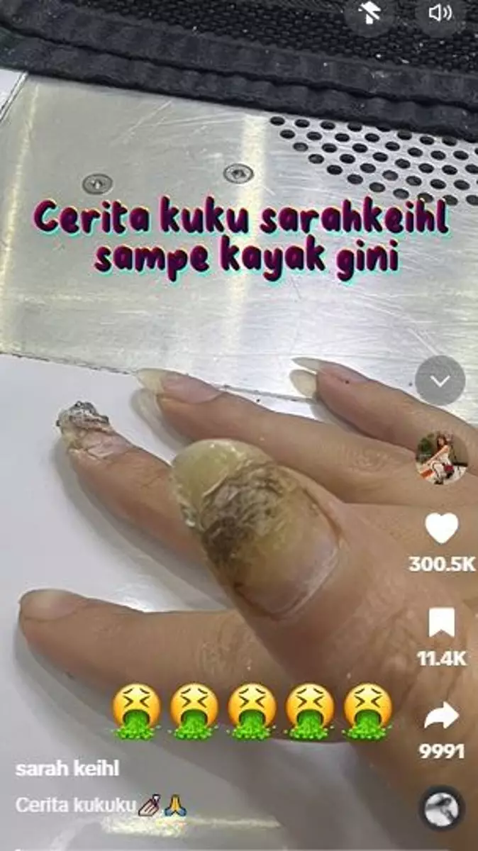 Kuku selebgram ini jadi busuk usai lakukan nail art TikTok