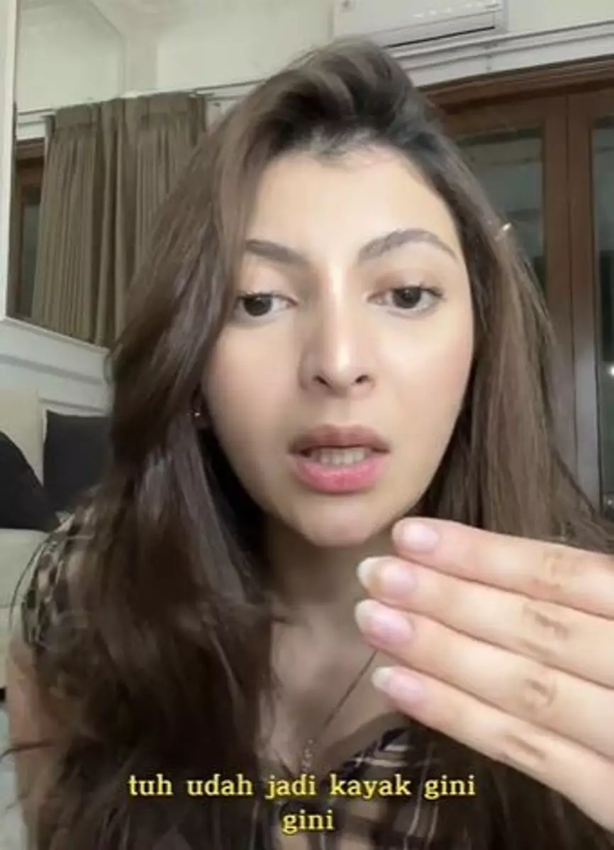 Kuku selebgram ini jadi busuk usai lakukan nail art TikTok