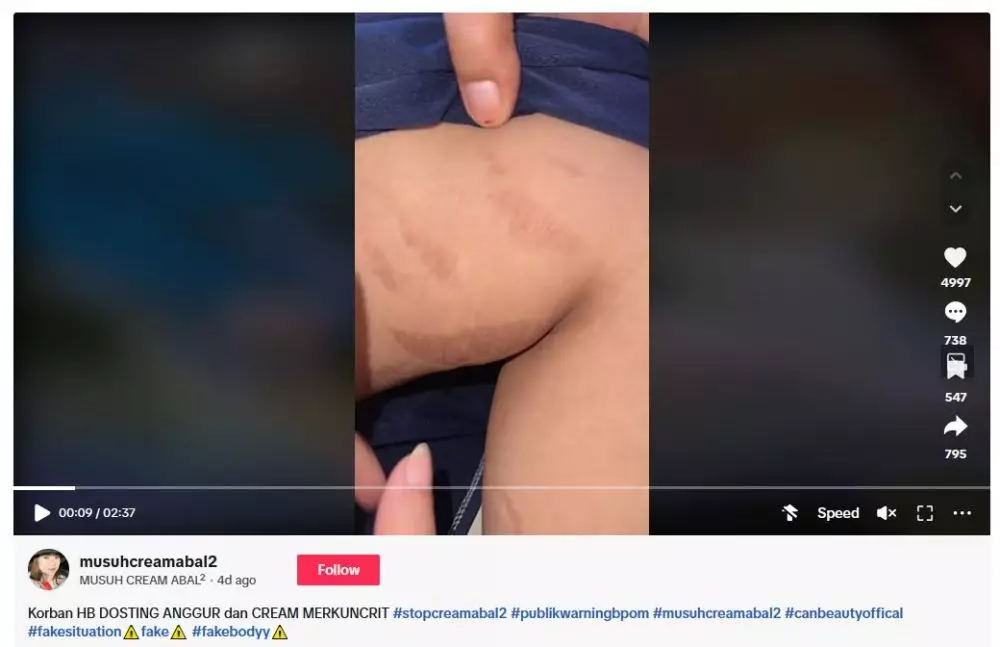 kisah wanita pakai HB dosting dan krim abal-abal berbagai sumber