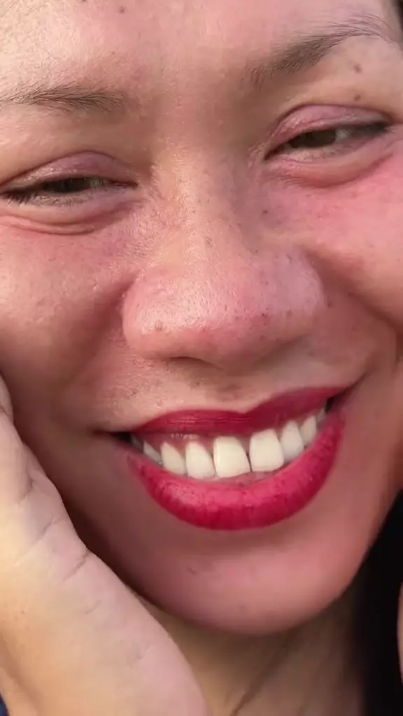 kisah wanita pakai HB dosting dan krim abal-abal berbagai sumber