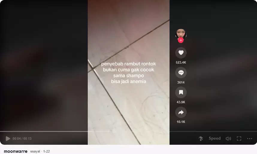 Kisah cewek alami kerontokan karena anemia berbagai sumber