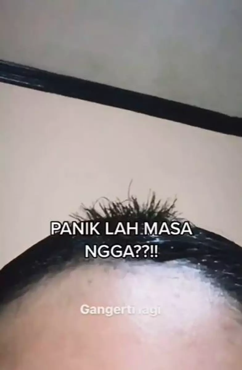 Cewek bleaching rambut sendiri malah rontok kayak mi bihun TikTok