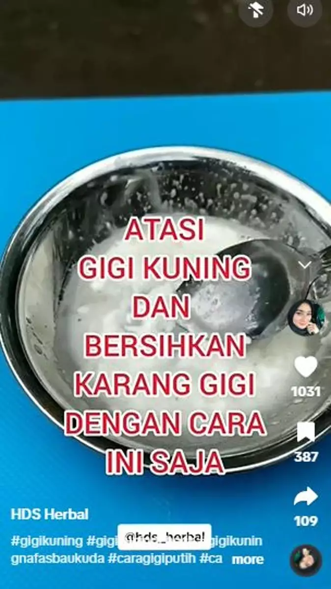 Bahan memasak bisa bikin gigi kuning jadi auto putih Berbagai sumber