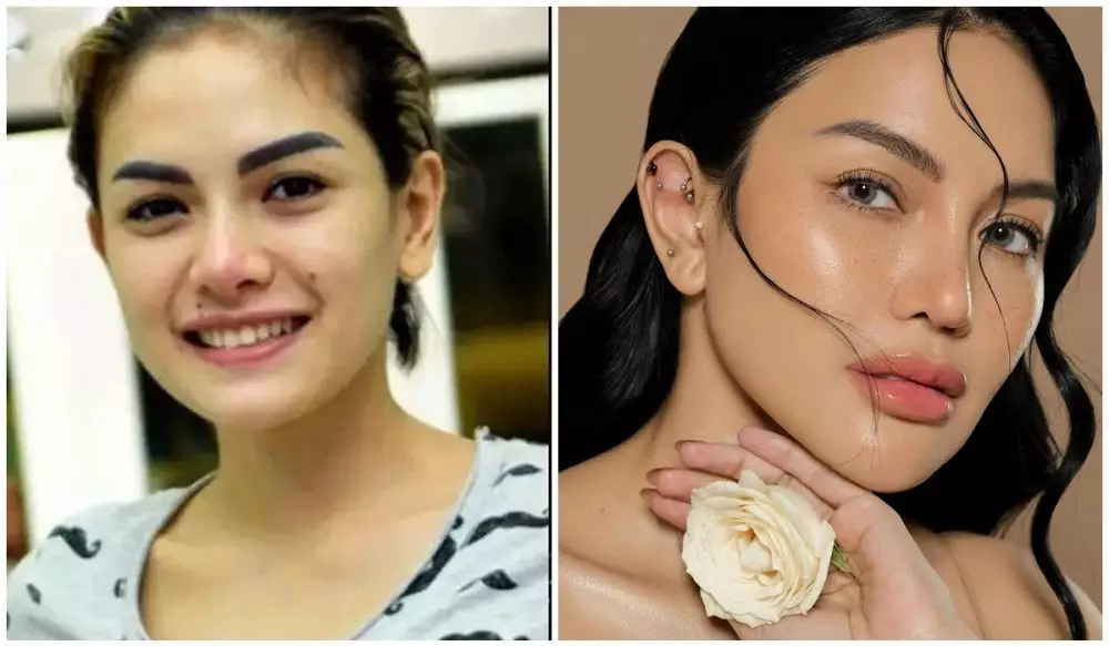 potret sebelum & sesudah Nikita Mirzani berbagai sumber potret sebelum & sesudah Nikita Mirzani berbagai sumber