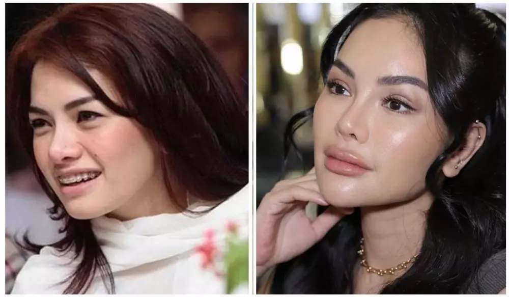 potret sebelum & sesudah Nikita Mirzani berbagai sumber potret sebelum & sesudah Nikita Mirzani berbagai sumber