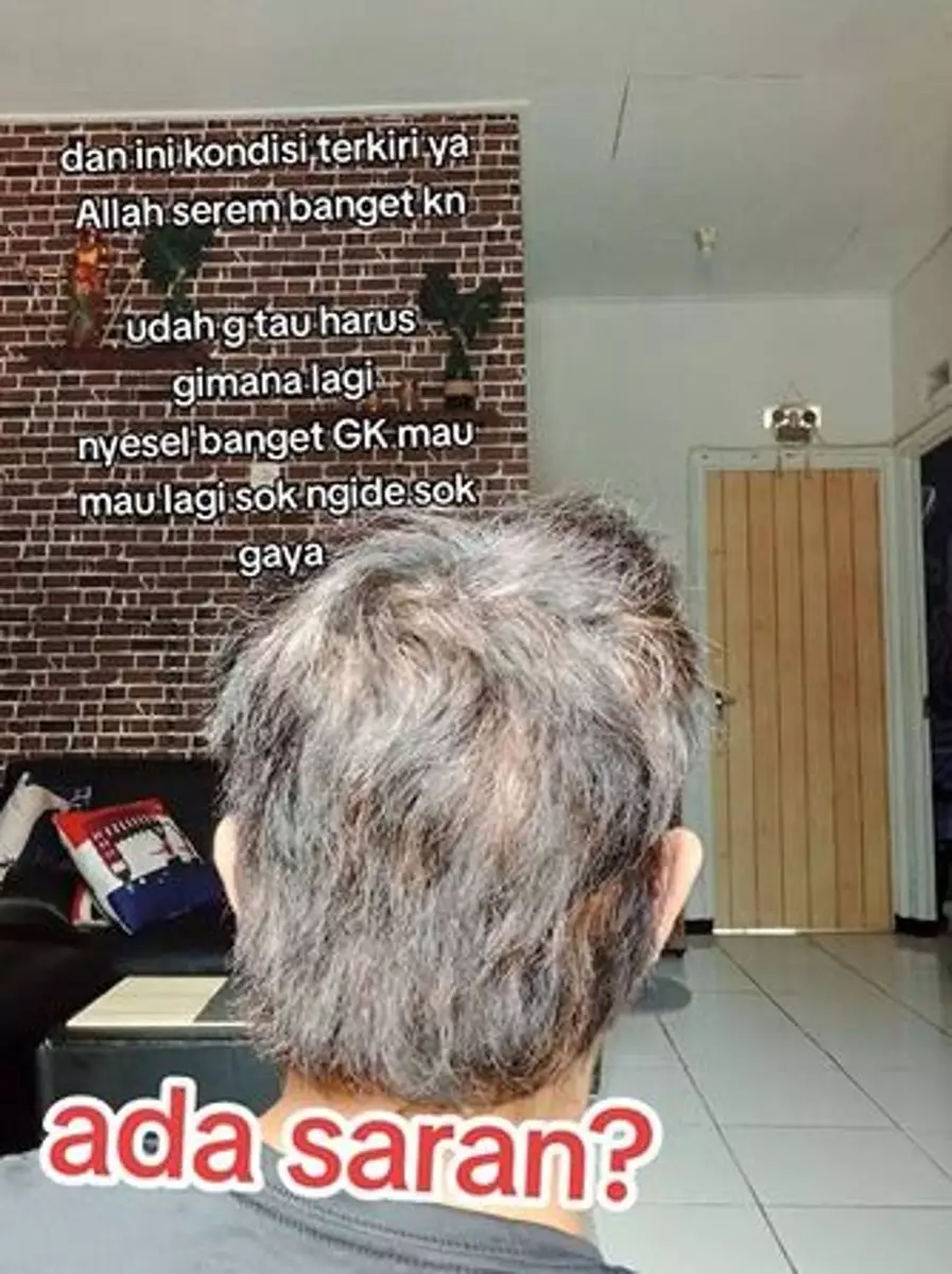 Rambut cowok ini jadi mirip sapu ijuk usai hair coloring TikTok