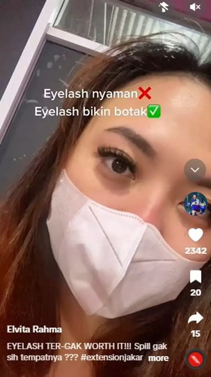Bulu mata cewek ini jadi botak usai eyelash extension TikTok