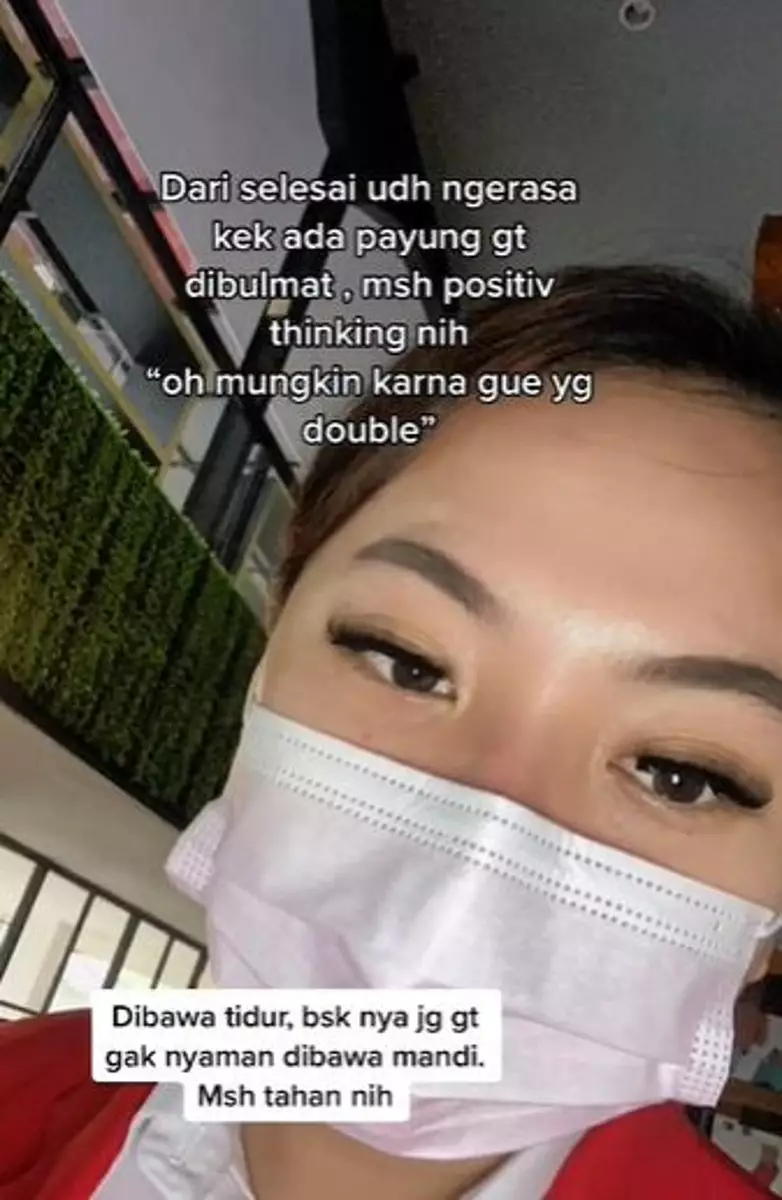 Bulu mata cewek ini jadi botak usai eyelash extension TikTok