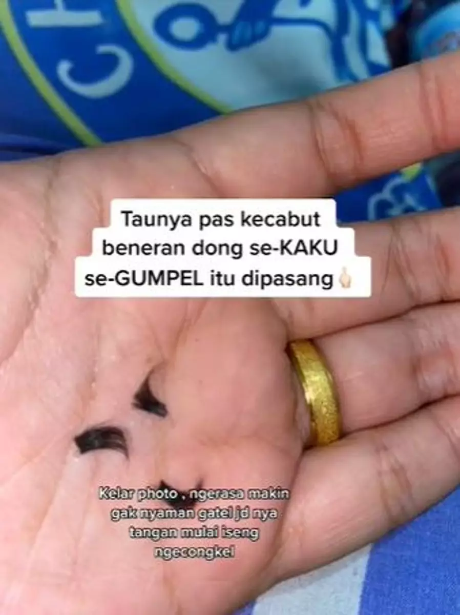 Bulu mata cewek ini jadi botak usai eyelash extension TikTok