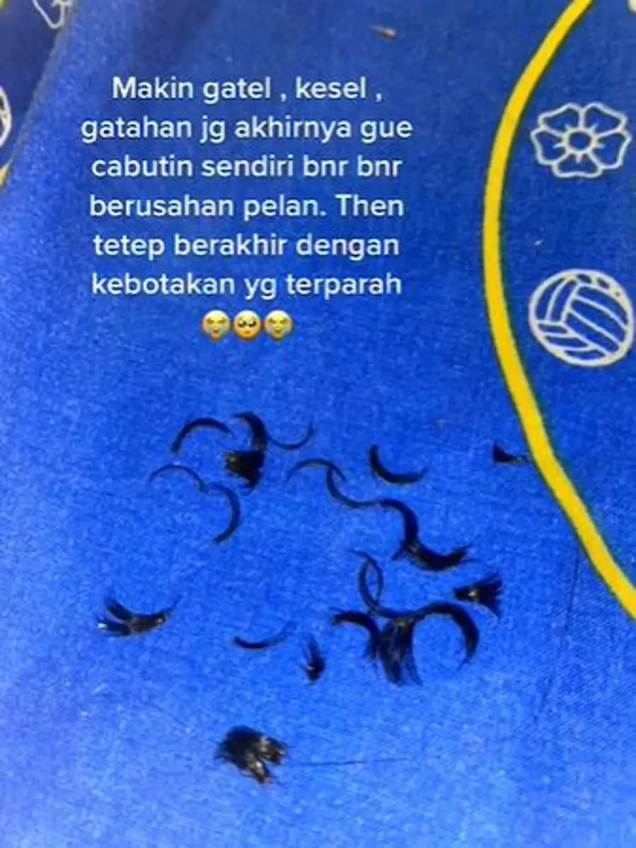 Bulu mata cewek ini jadi botak usai eyelash extension TikTok