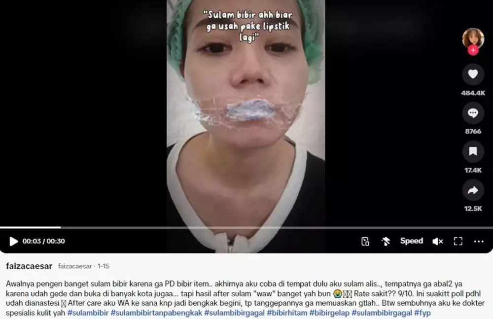 Hasil sulam bibir cewek ini malah bak disengat tawon TikTok Hasil sulam bibir cewek ini malah bak disengat tawon TikTok