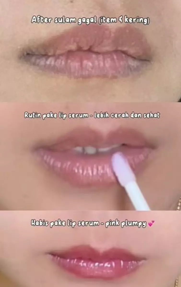 Hasil sulam bibir cewek ini malah bak disengat tawon TikTok Hasil sulam bibir cewek ini malah bak disengat tawon TikTok