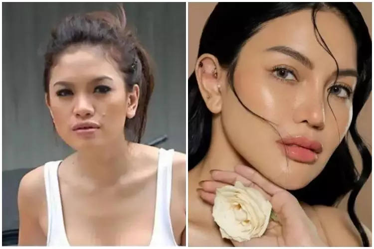 11 Seleb ini rela habiskan biaya fantastis untuk oplas Berbagai sumber