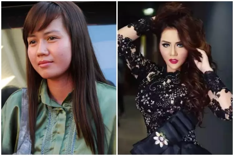 11 Seleb ini rela habiskan biaya fantastis untuk oplas Berbagai sumber