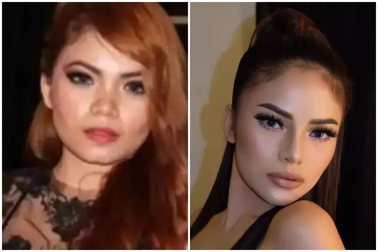 11 Seleb ini rela habiskan biaya fantastis untuk oplas Berbagai sumber