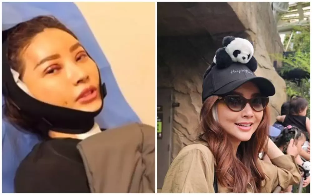 Potret Sarwendah sebelum dan sesudah permak wajah berbagai sumber