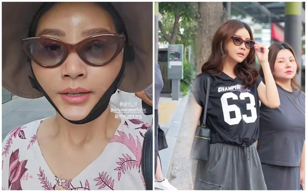 Potret Sarwendah sebelum dan sesudah permak wajah berbagai sumber