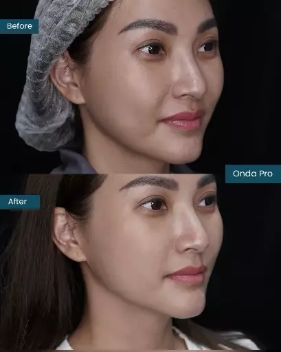 Potret Sarwendah sebelum dan sesudah permak wajah berbagai sumber