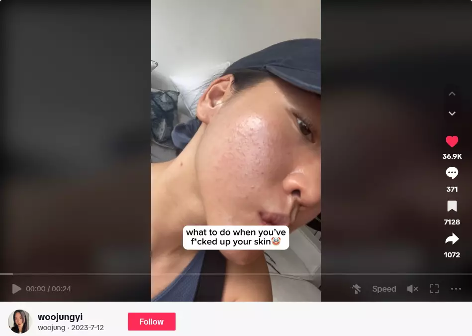 Wajah jadi breakout usai pakai sunscreen berbagai sumber