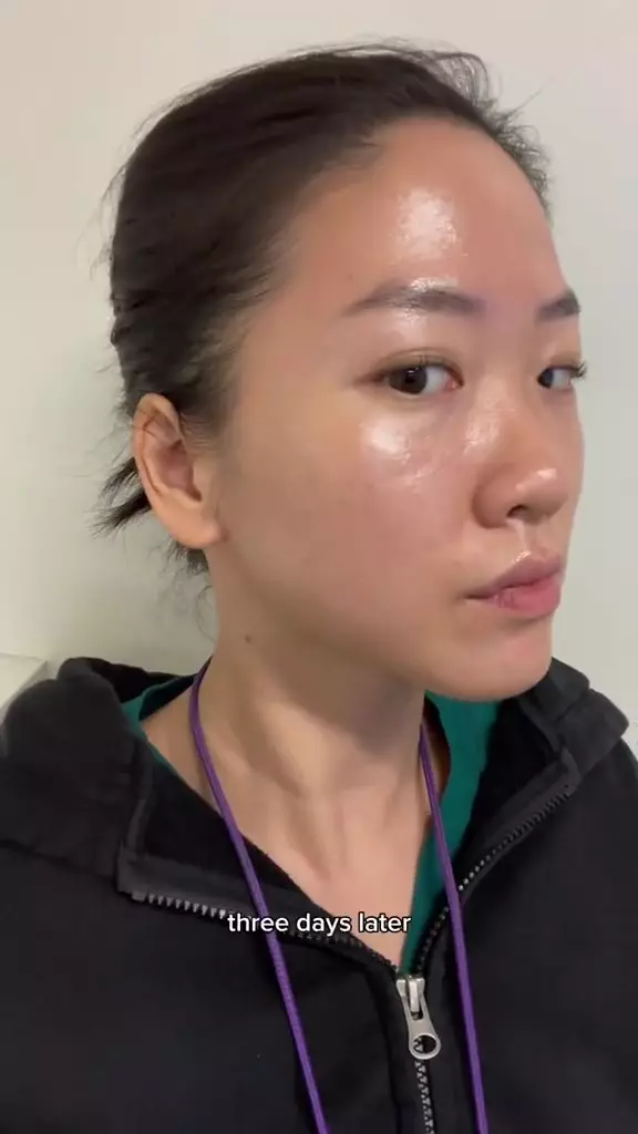 Wajah jadi breakout usai pakai sunscreen berbagai sumber