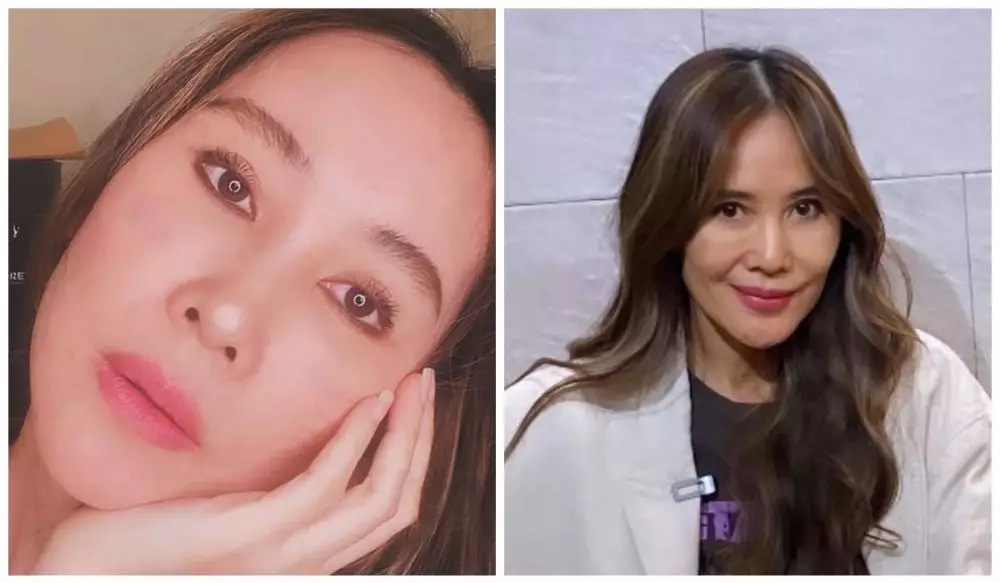 Ina Thomas operasi plastik berbagai sumber