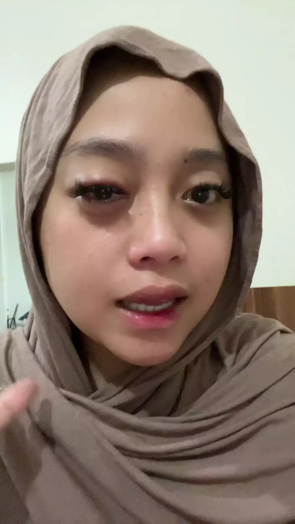 pakai soft lens mata iritasi berbagai sumber