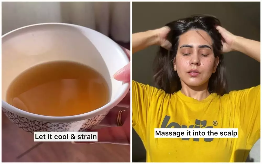 atasi rambut rontok berlebih. berbagai sumber