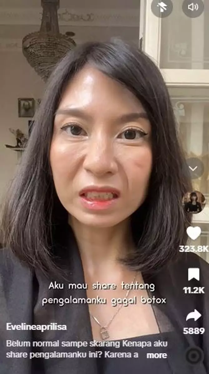 Treatment botoks biar cantik malah wajah kaku dan nggak bisa senyum TikTok