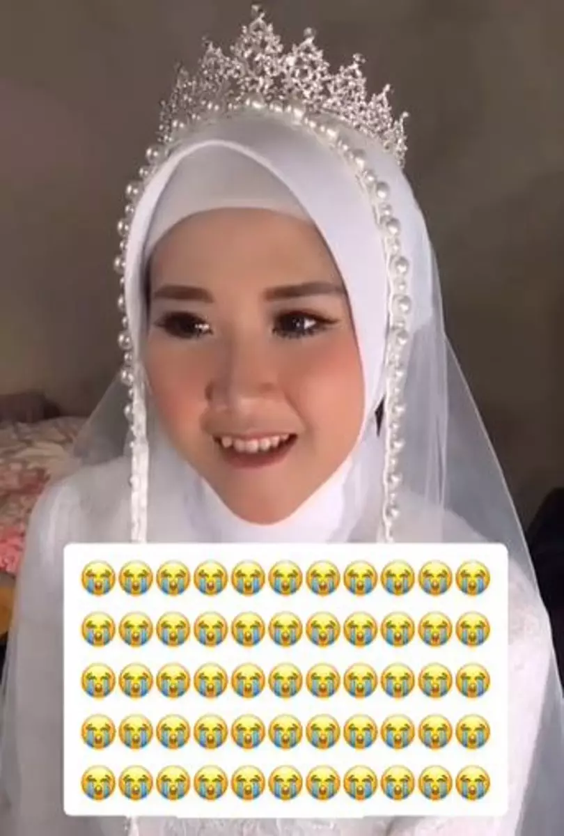 Alami kecelakaan H-1 menikah bikin wajah luka  TikTok